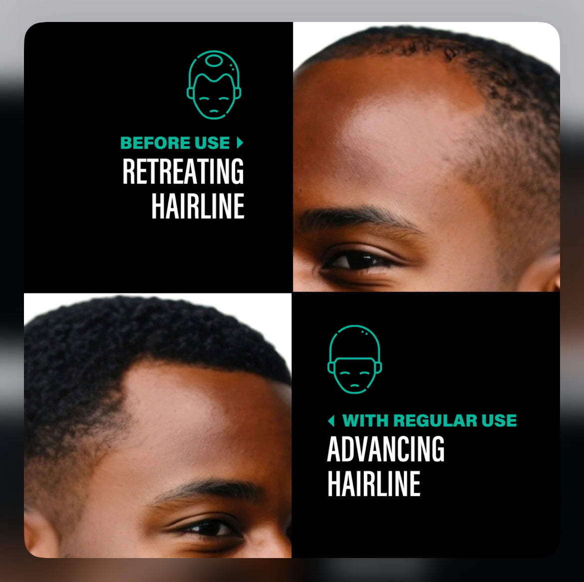 BATANA OIL (Pre-Order)